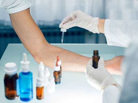 Doctor administering an allergy skin test on a patient's arm.